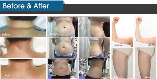 slimming machine products results show